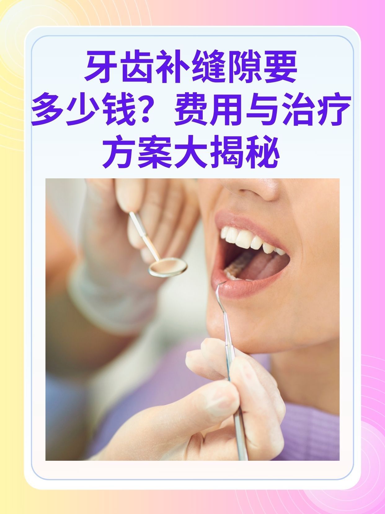 抚州补牙医保可以报销吗(补牙医保可以报销吗 哪些可以报销呢)